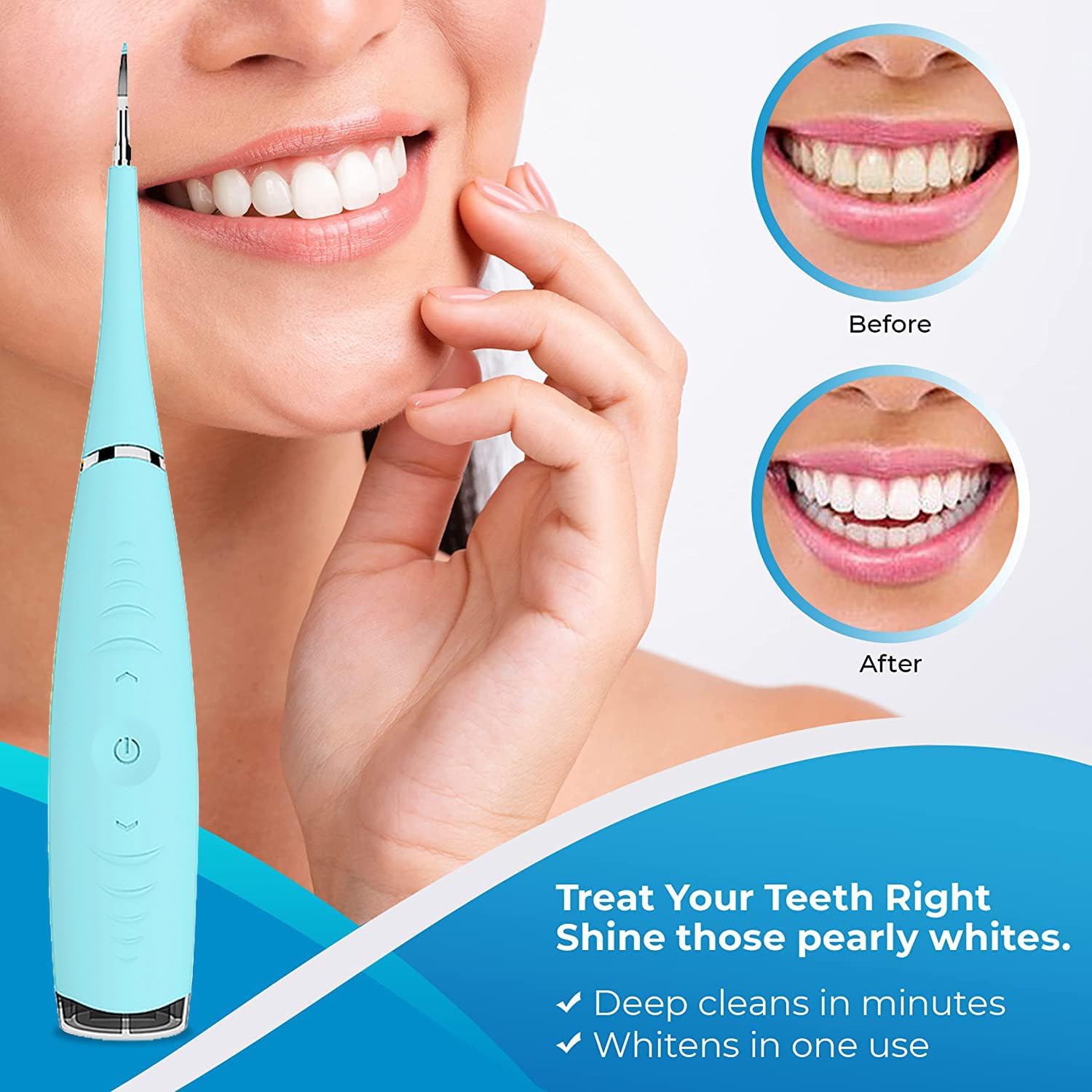 ultrasonic dental cleaning kit with advanced plaque removal for home oral care ultrasonic dental cleaning kit with advanced plaque removal for home oral care